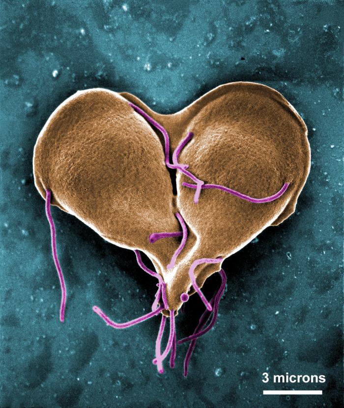 giardiasis